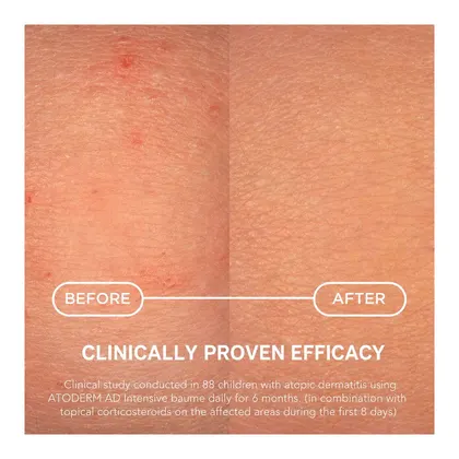 Bioderma Atoderm AD Intensive Baume 400ml — foto 5